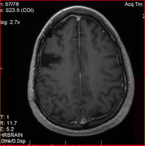 alt text image of my brain mri