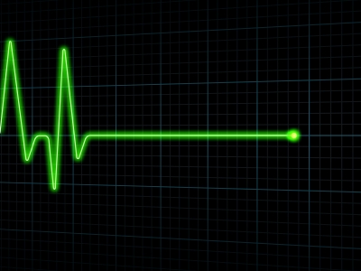 alt text for an image of a pulse stopping on ECG